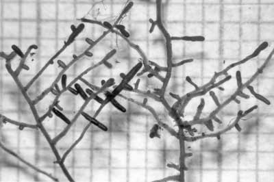 Ectomycorrhizal short roots (16KB)