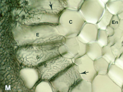 Hartig net of ectomycorrhizal Populus root