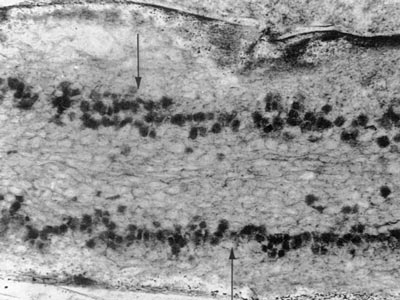 400 MY old fossil mycorrhiza-like association in Aglaophyton rhizome