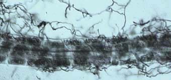 Leucopogon hair root (11KB)