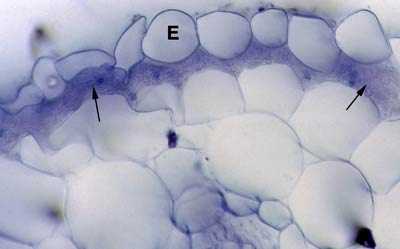 Thysanotus sub-epidermal mycorrhias