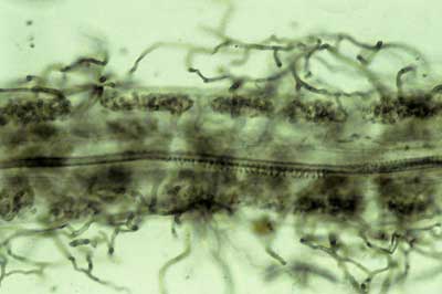 Leucopogon mycorrhiza (16KB)