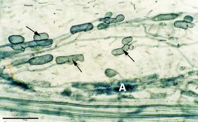 Acaulospora vesicles 