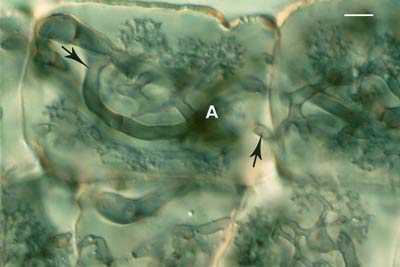 Erythronium coil arbuscules