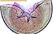 Spore of Acaulospora (8KB)