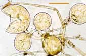 Glomus spores (6KB)