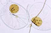 Scutellospora spore (4KB)