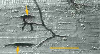 enty points on root surface (15KB)